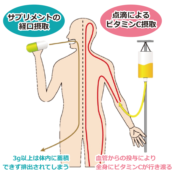 点滴 ビタミン 高 効果 c 濃度 くすりの話 130